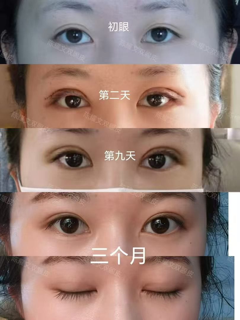 案例1