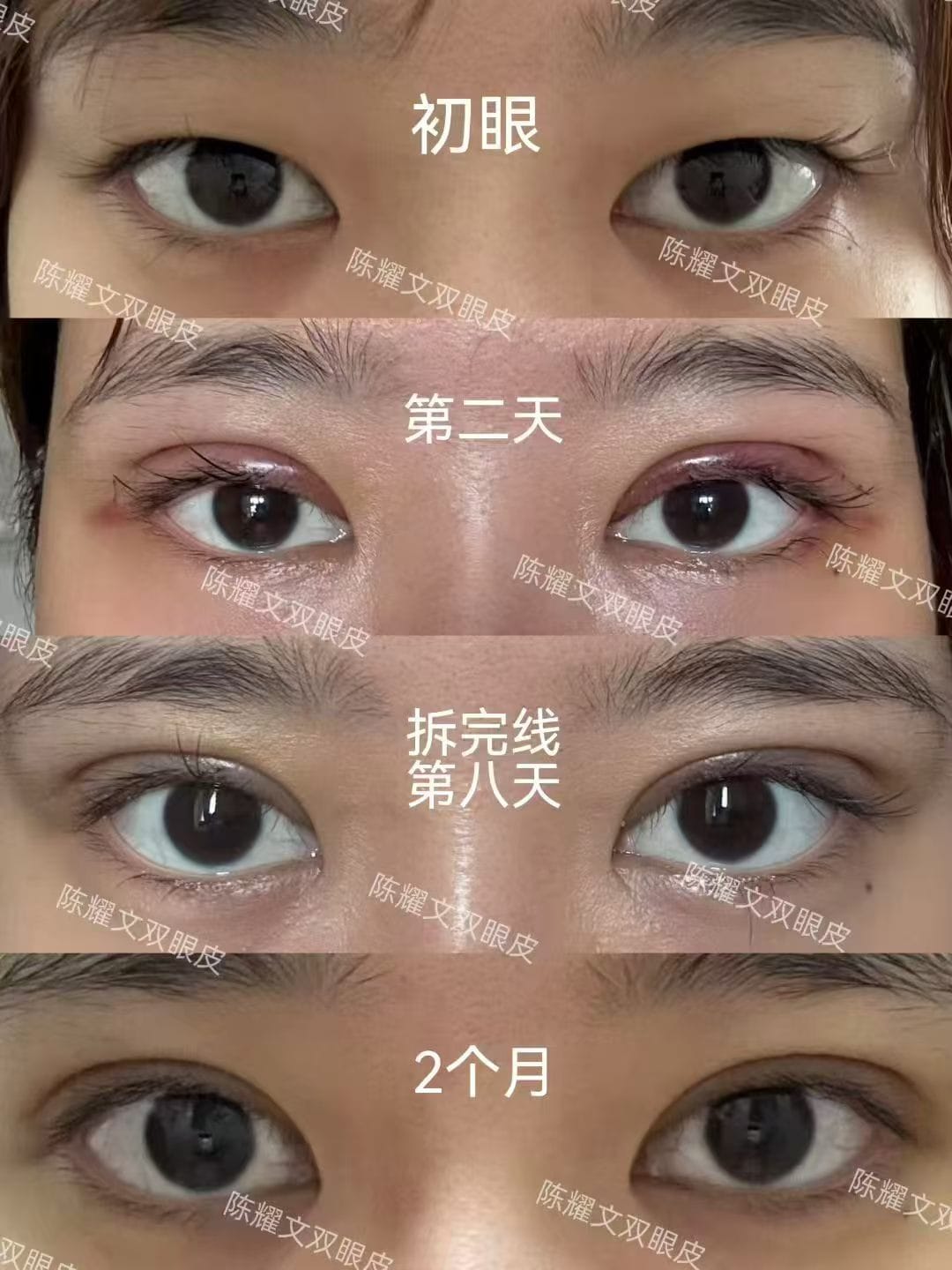 案例3