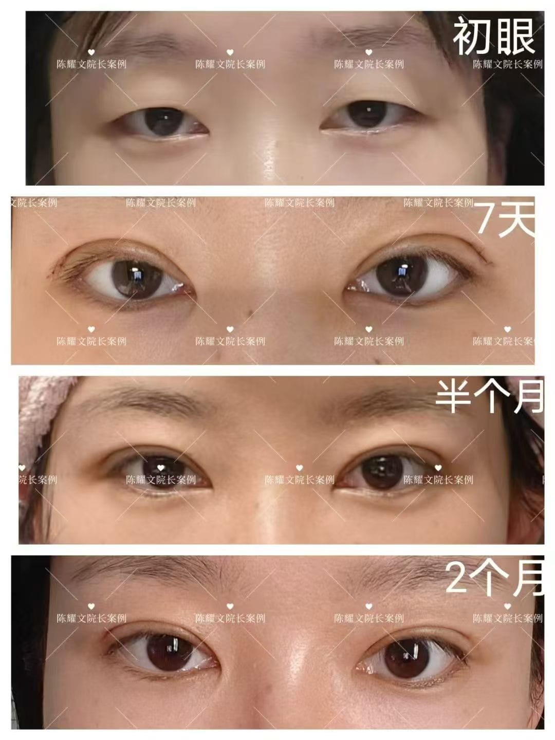 案例8